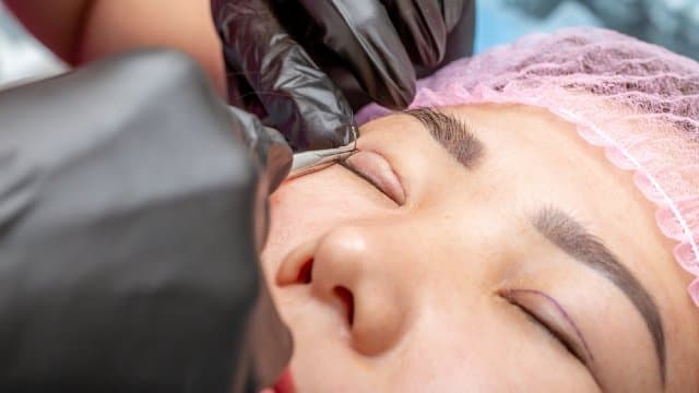 Brow & Forehead Thread Lift