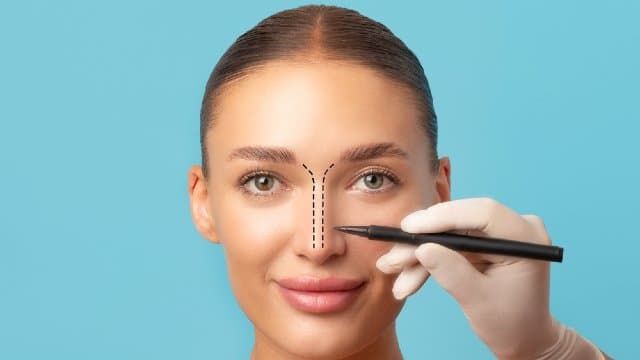 Nose Surgery