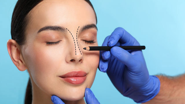 Cosmetic Rhinoplasty